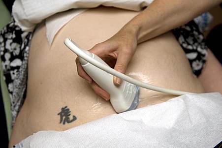 Image of an adult's stomach getting an ultrasound scan.